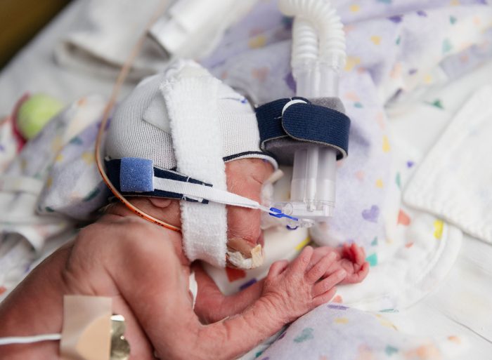 23 week newborn baby