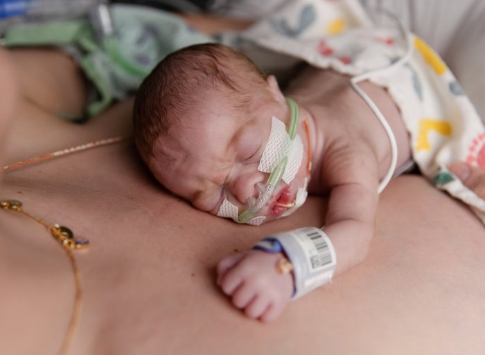 25 week baby photos