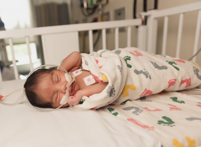 Saint vincent hospital nicu