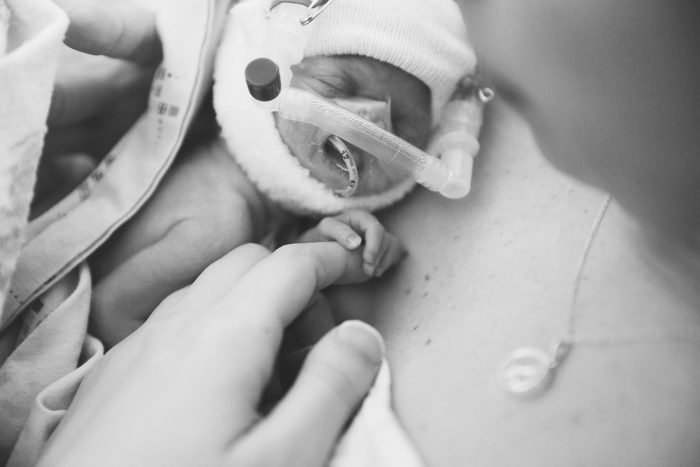 micro preemie