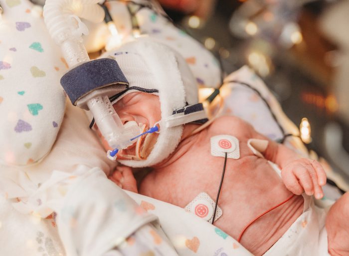 micro preemie nicu babies