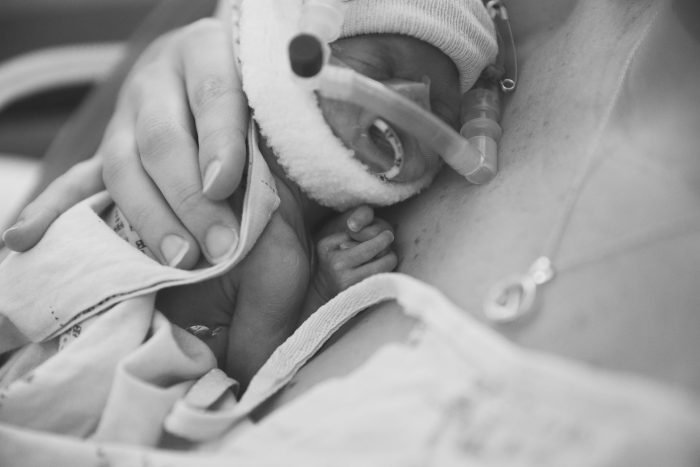 micro preemie photography