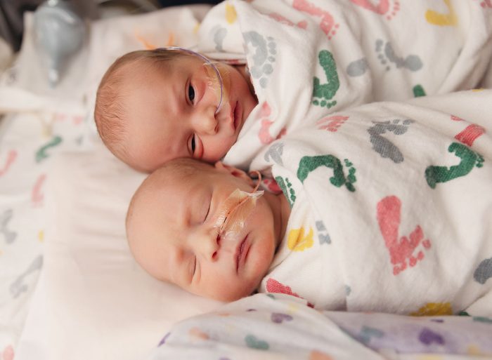 newborn twins st vincents portland